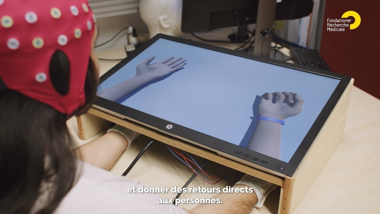 AVC : améliorer la motricité post-AVC grâce aux neurosciences et à l’intelligence artificielle