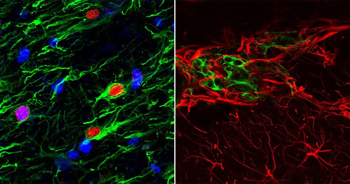 L’implantation de l’hydrogel au niveau du site de la lésion du cortex attire différentes populations de cellule de l’hôte dans une tentative de réparation.