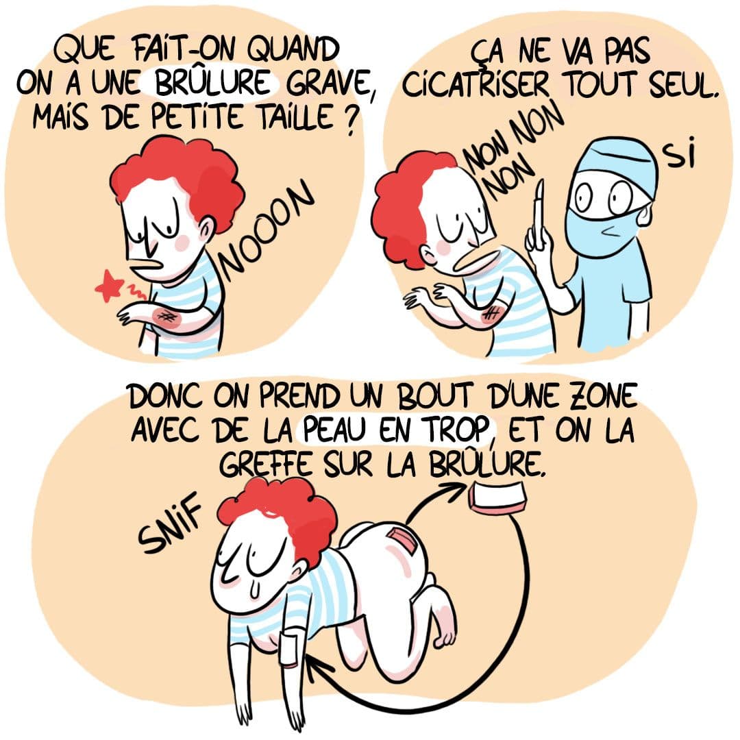 Case 2 de la BD "La femme enceinte au secours des grands brûlés""