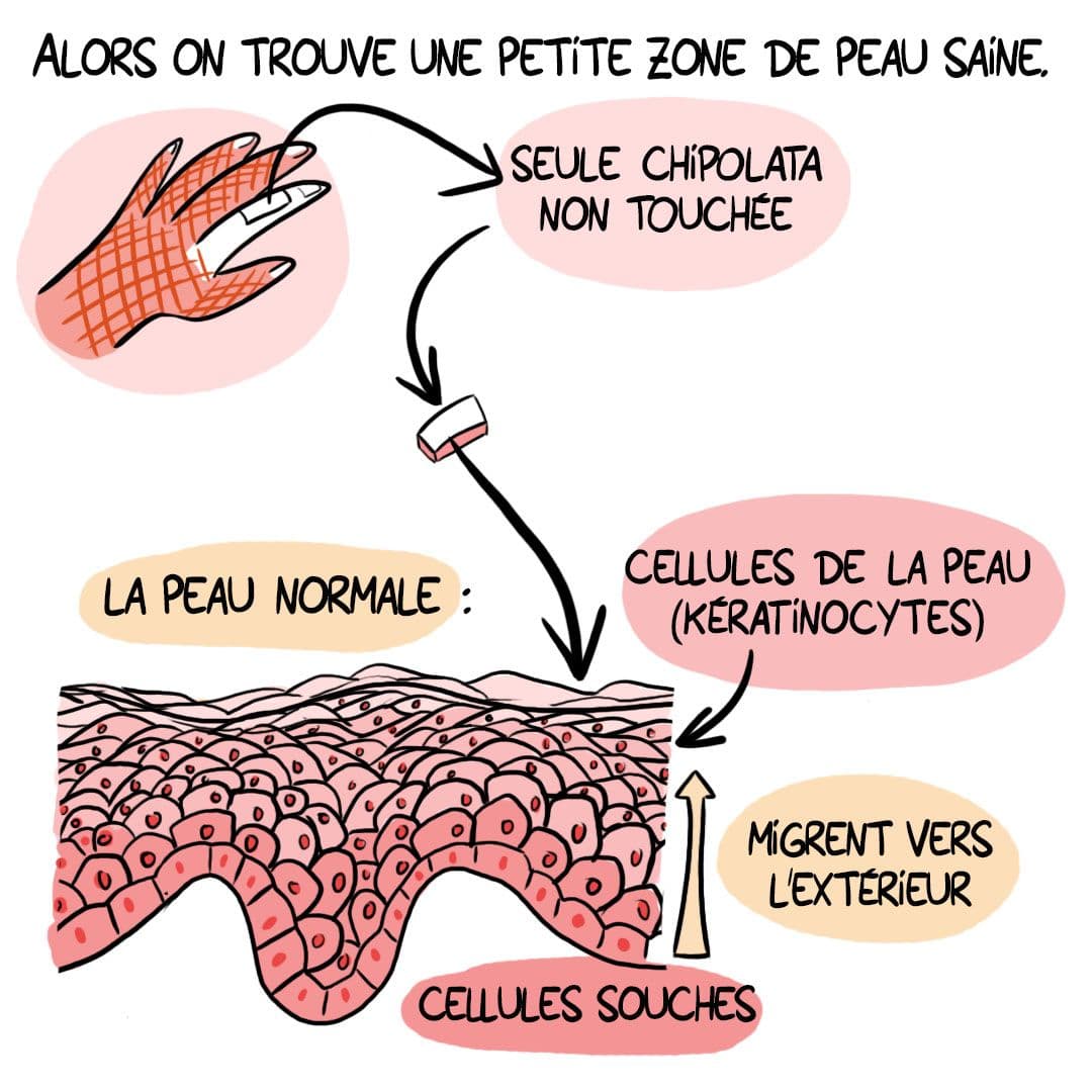 Case 4 de la BD "La femme enceinte au secours des grands brûlés""