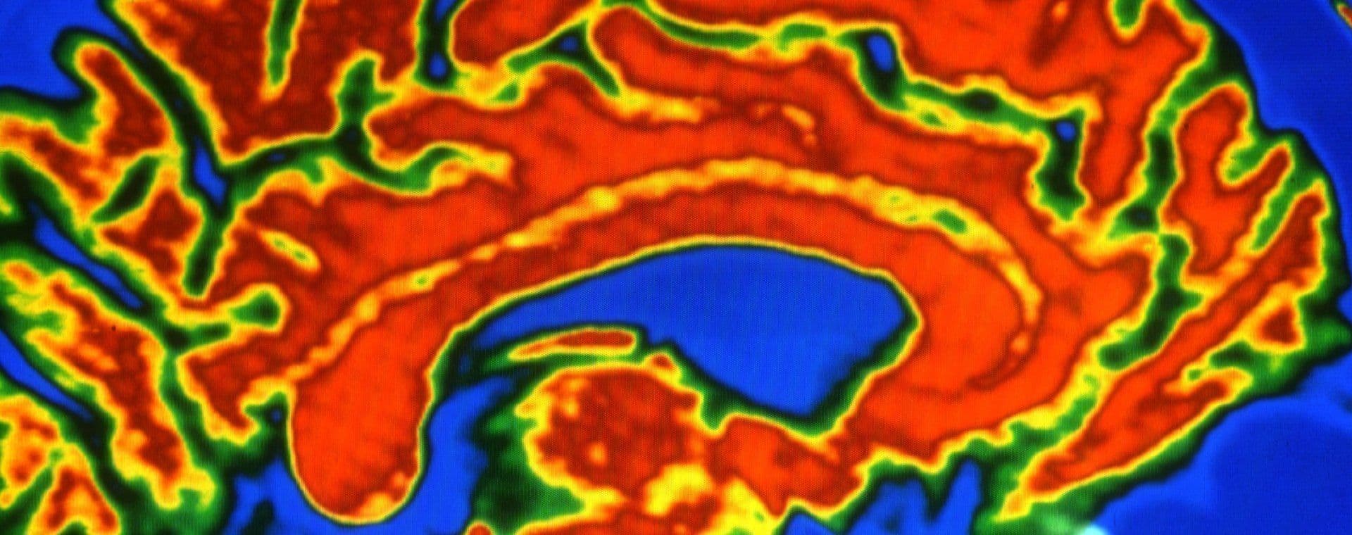 Un diagnostic encore trop tardif