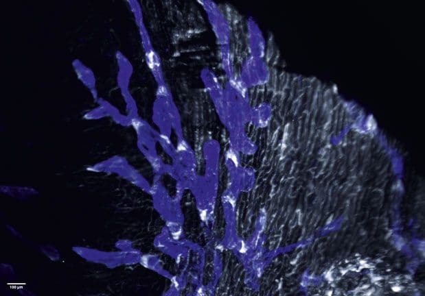 Photo du système lymphatique