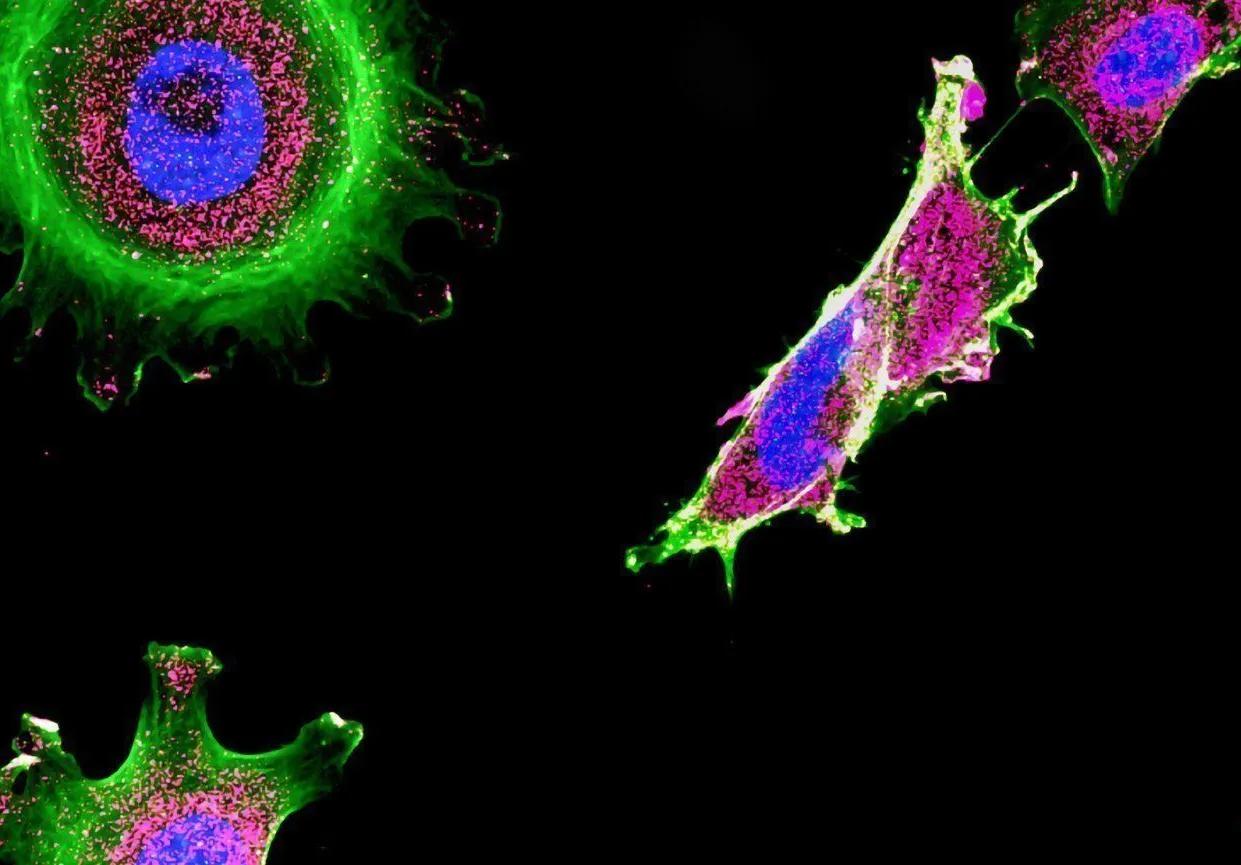 immunofluorescence de multiples cellules cancéreuses