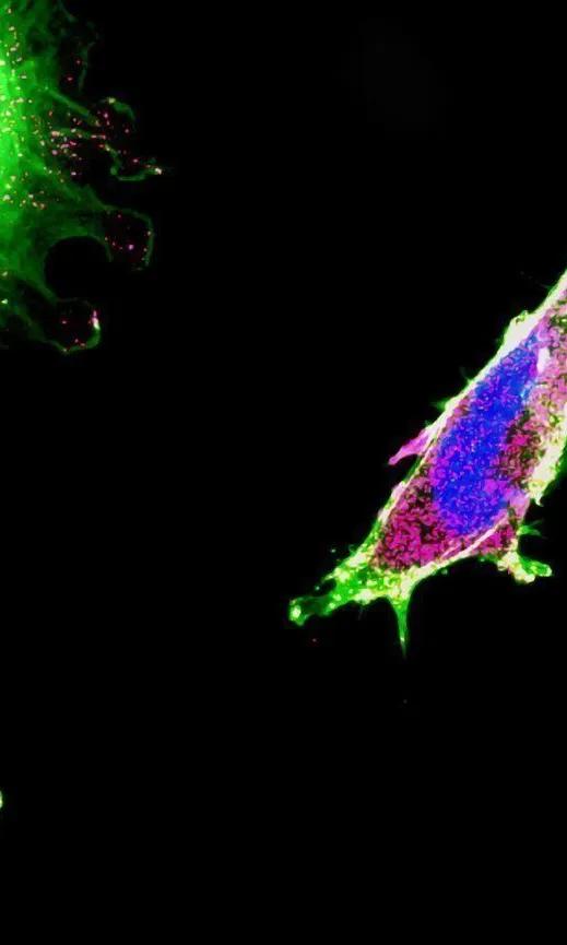 immunofluorescence de multiples cellules cancéreuses