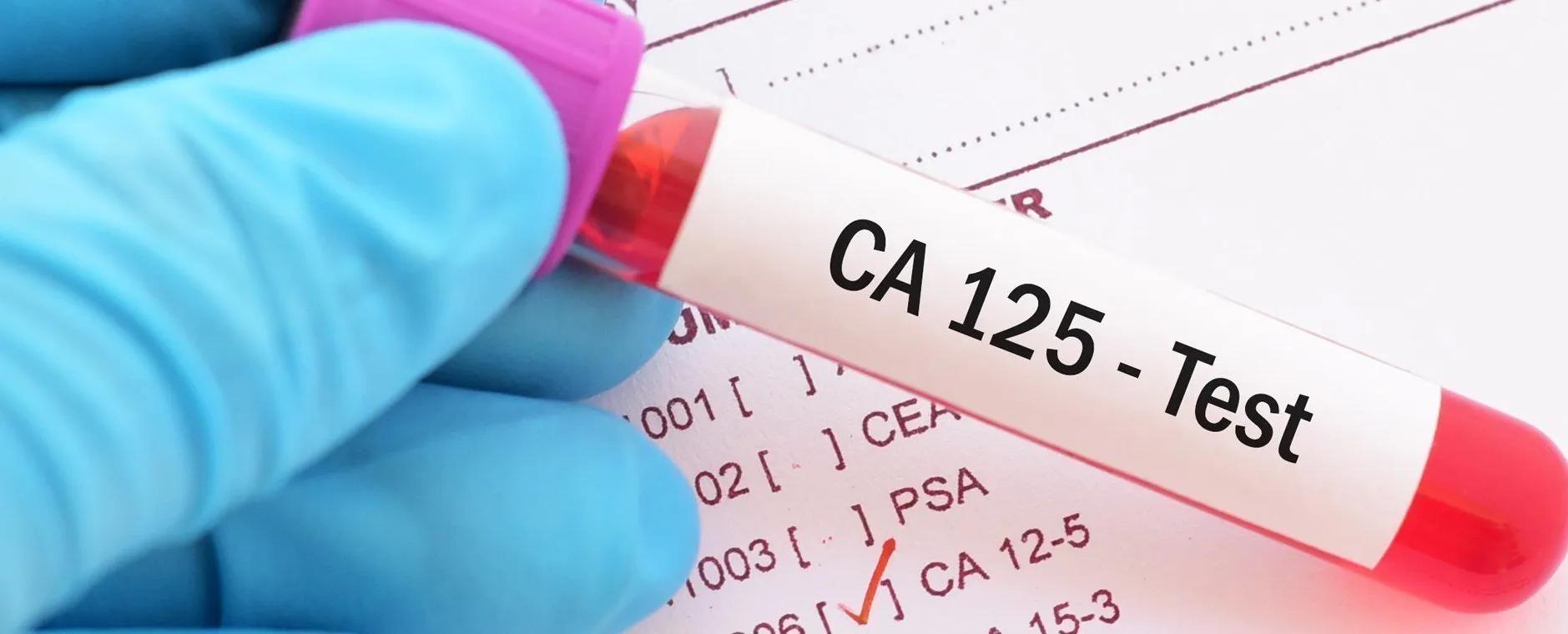 La protéine CA 125 comme outil de suivi