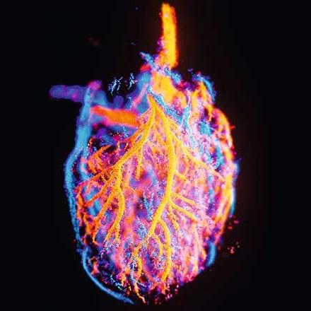 Technique d’imagerie médicale unique en son genre, qui permet de visualiser distinctement les petits vaisseaux sanguins au sein d’un organe, et d’y mesurer le débit sanguin.