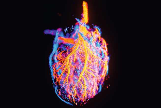 Technique d’imagerie médicale unique en son genre, qui permet de visualiser distinctement les petits vaisseaux sanguins au sein d’un organe, et d’y mesurer le débit sanguin.