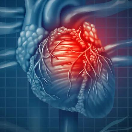 Le remodelage cardiaque et ses conséquences