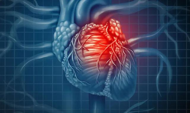 Le remodelage cardiaque et ses conséquences
