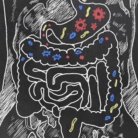MICI : moduler l’action du microbiote pour réduire l’inflammation intestinale