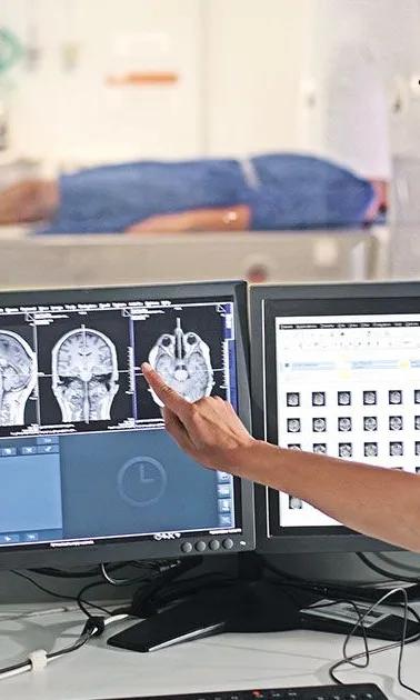 Douleurs neuropathiques : identifier les patients pouvant bénéficier de la stimulation magnétique transcrânienne.