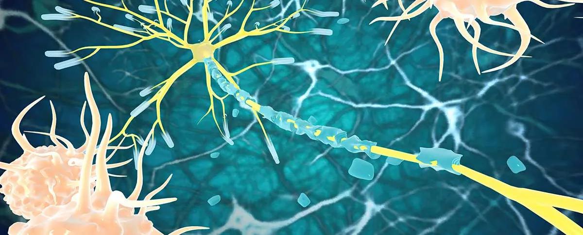 Illustration de la remyélinisation, phénomène par lequel de nouvelles gaines de myéline sont générées autour des axones du système nerveux central.