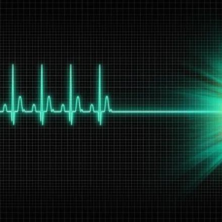Troubles du rythme cardiaque : un risque de fibrillation auriculaire augmenté après la perte d’un conjoint