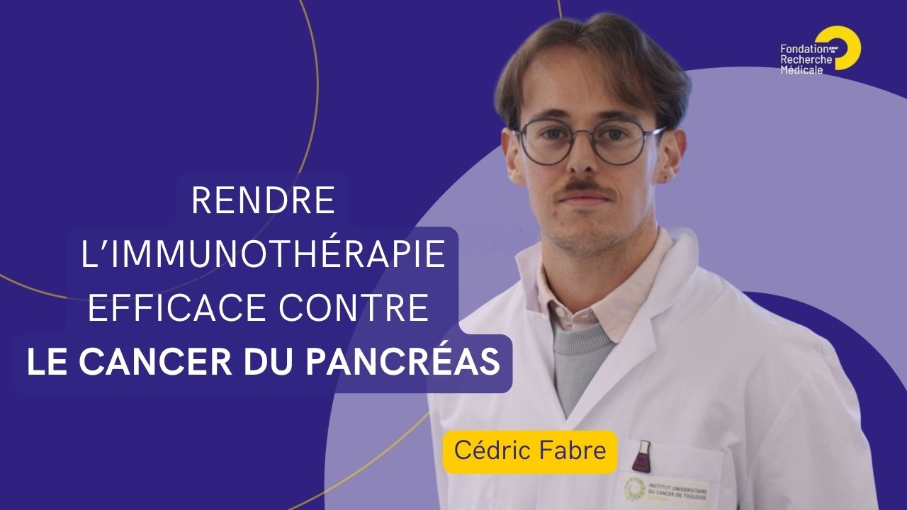 Cancer du pancréas : rendre l'immunothérapie plus efficace