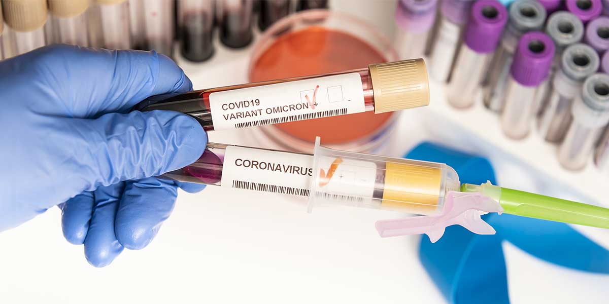 Épidémies de grippe et Covid : un nouveau test antigénique permet de  détecter les deux virus