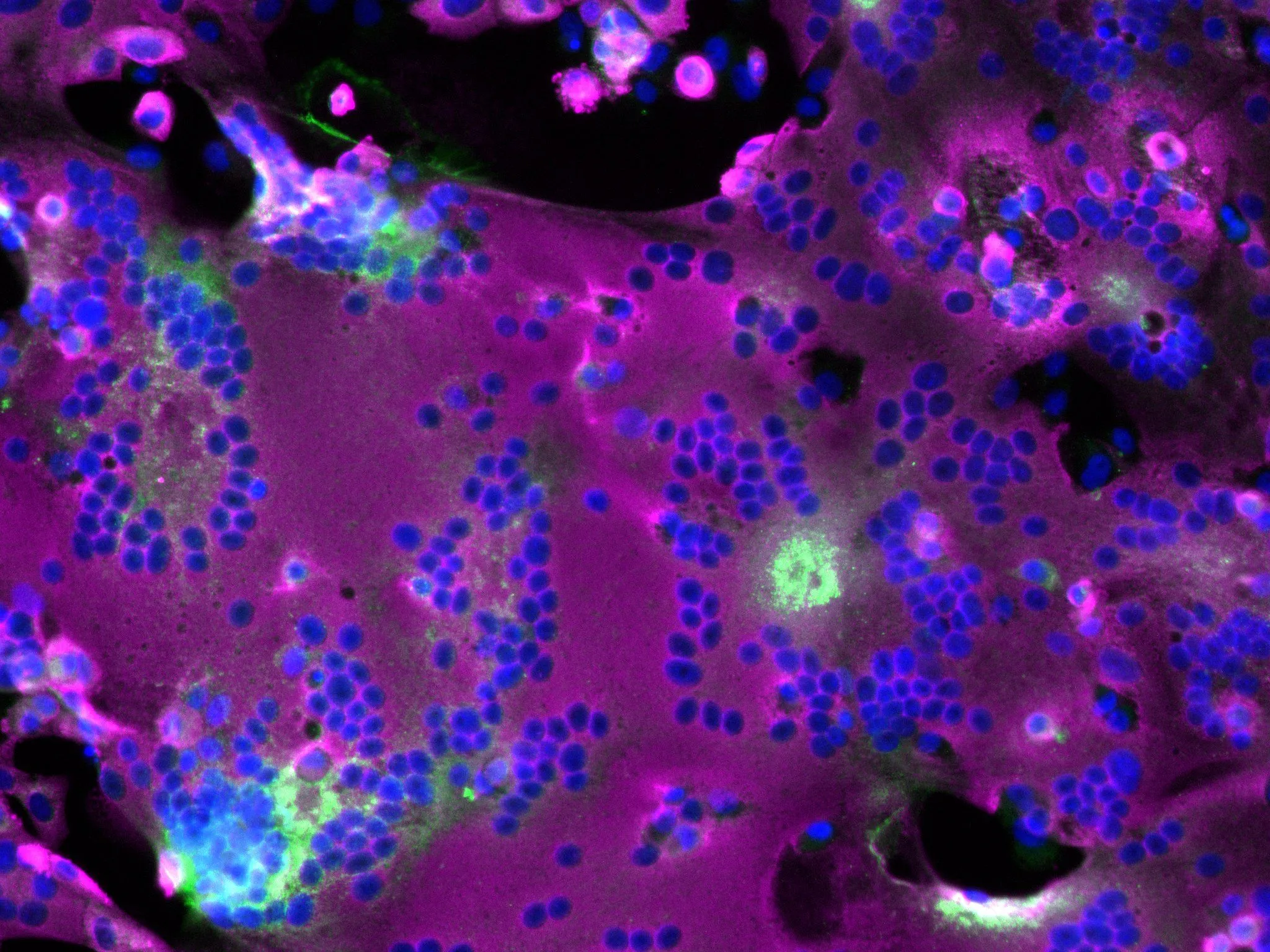 Illustration_Long_Covid_0c99157a92.jpg?s=1200x630&f=webp